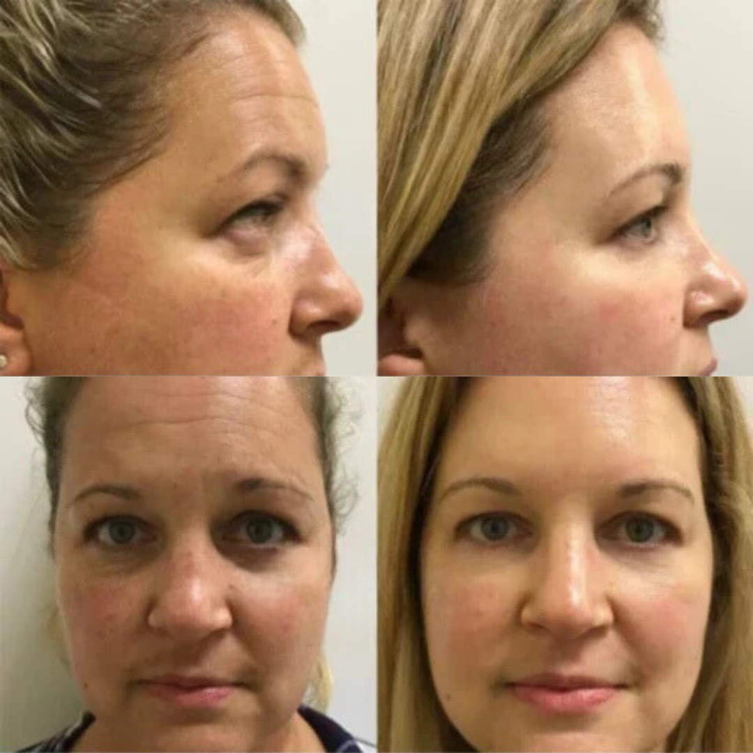 2 drops a day keeps the wrinkle away!