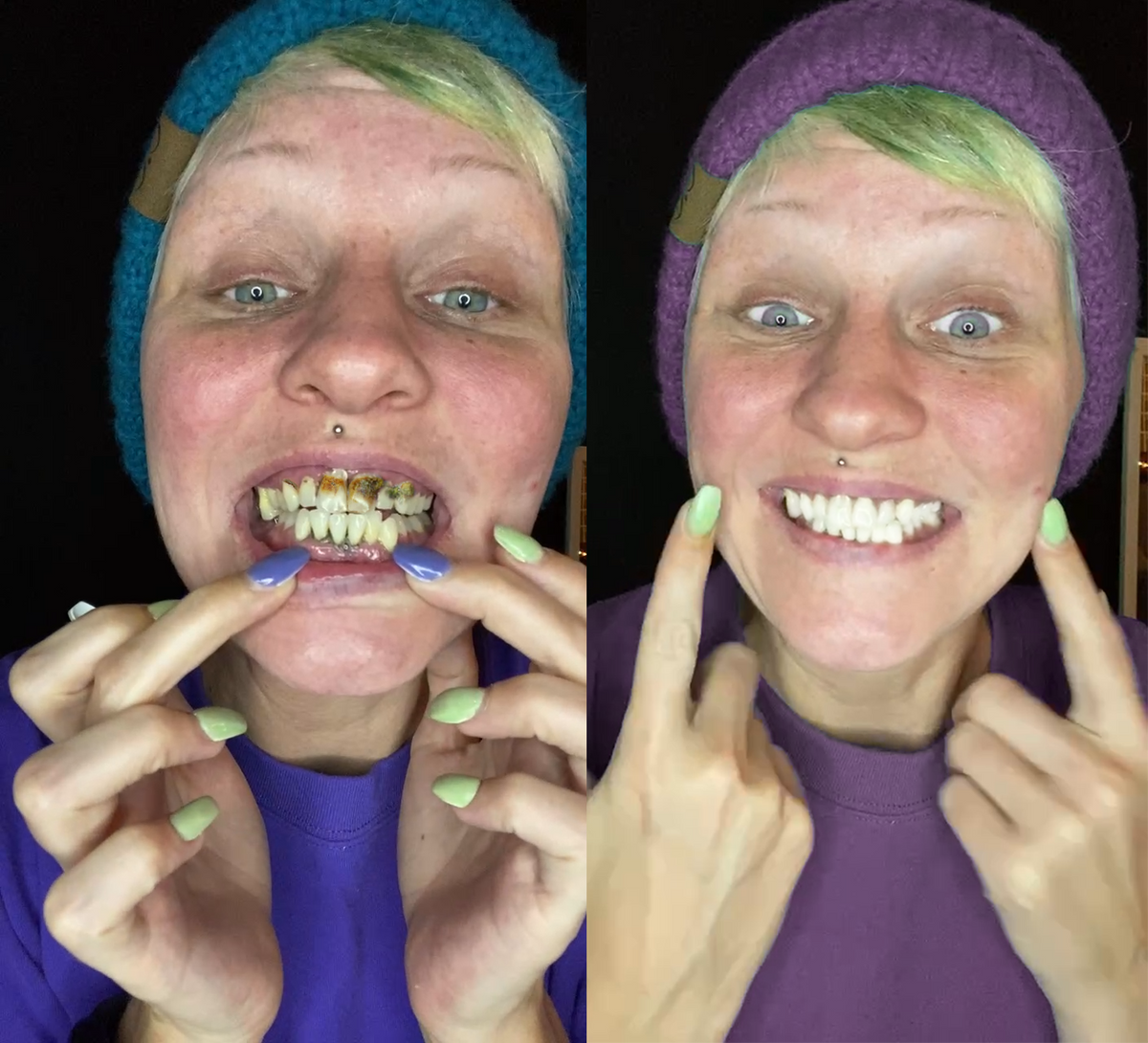 Beskyt & Styrk Dine Tænder