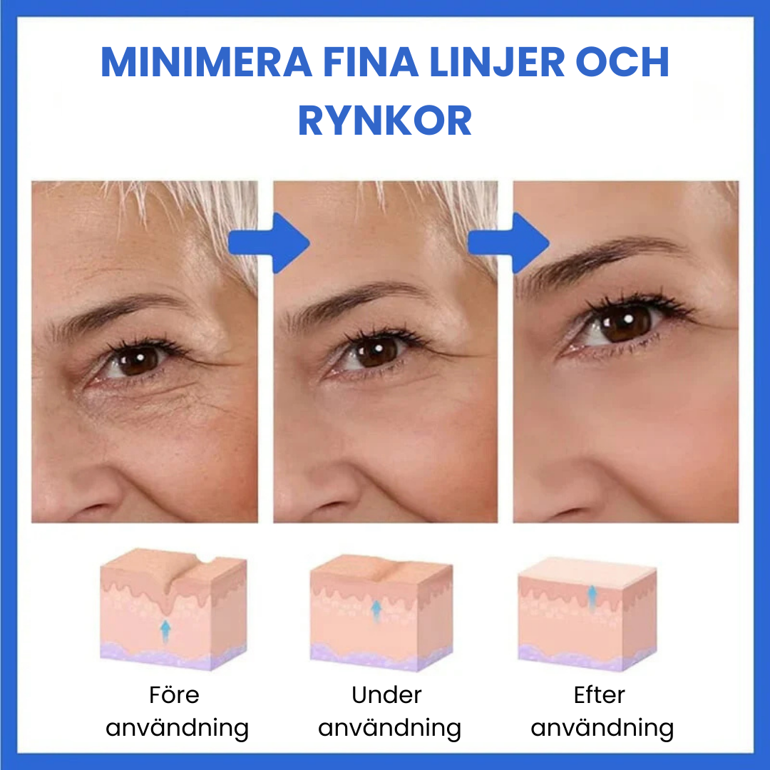 Wrinkle-free skin in just minutes!