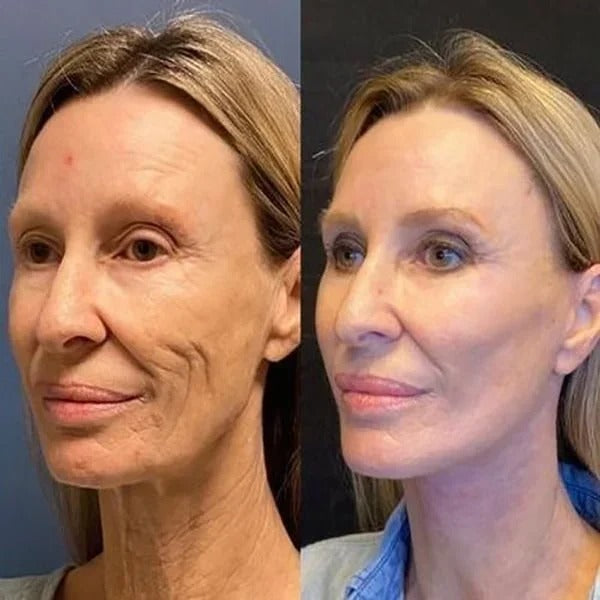 2 drops a day keeps the wrinkle away!