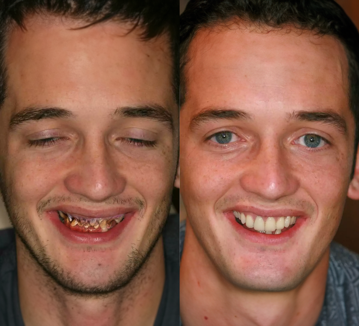 Beskyt & Styrk Dine Tænder