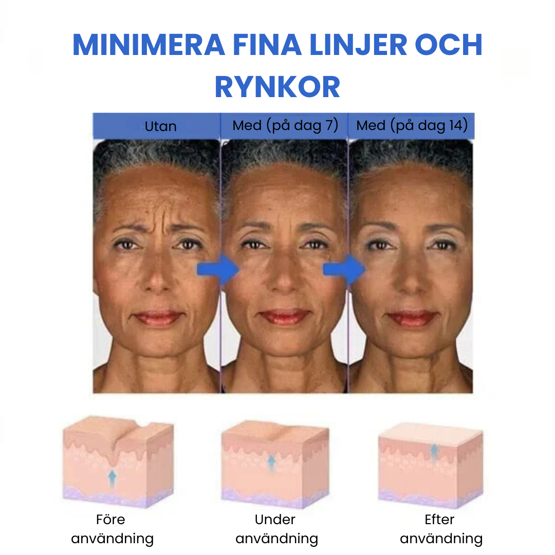 Wrinkle-free skin in just minutes!