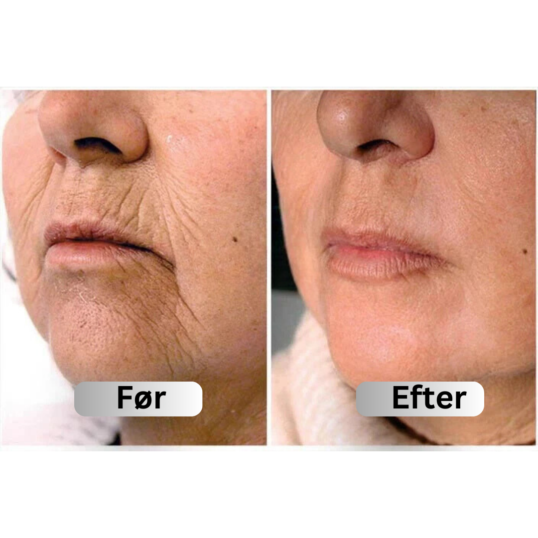 2 drops a day keeps the wrinkle away!