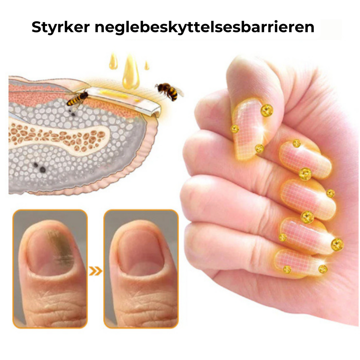 Stop ødelagte negle for altid