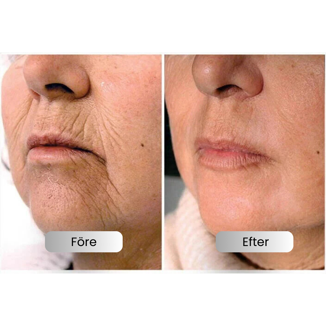 Wrinkle-free skin in just minutes!