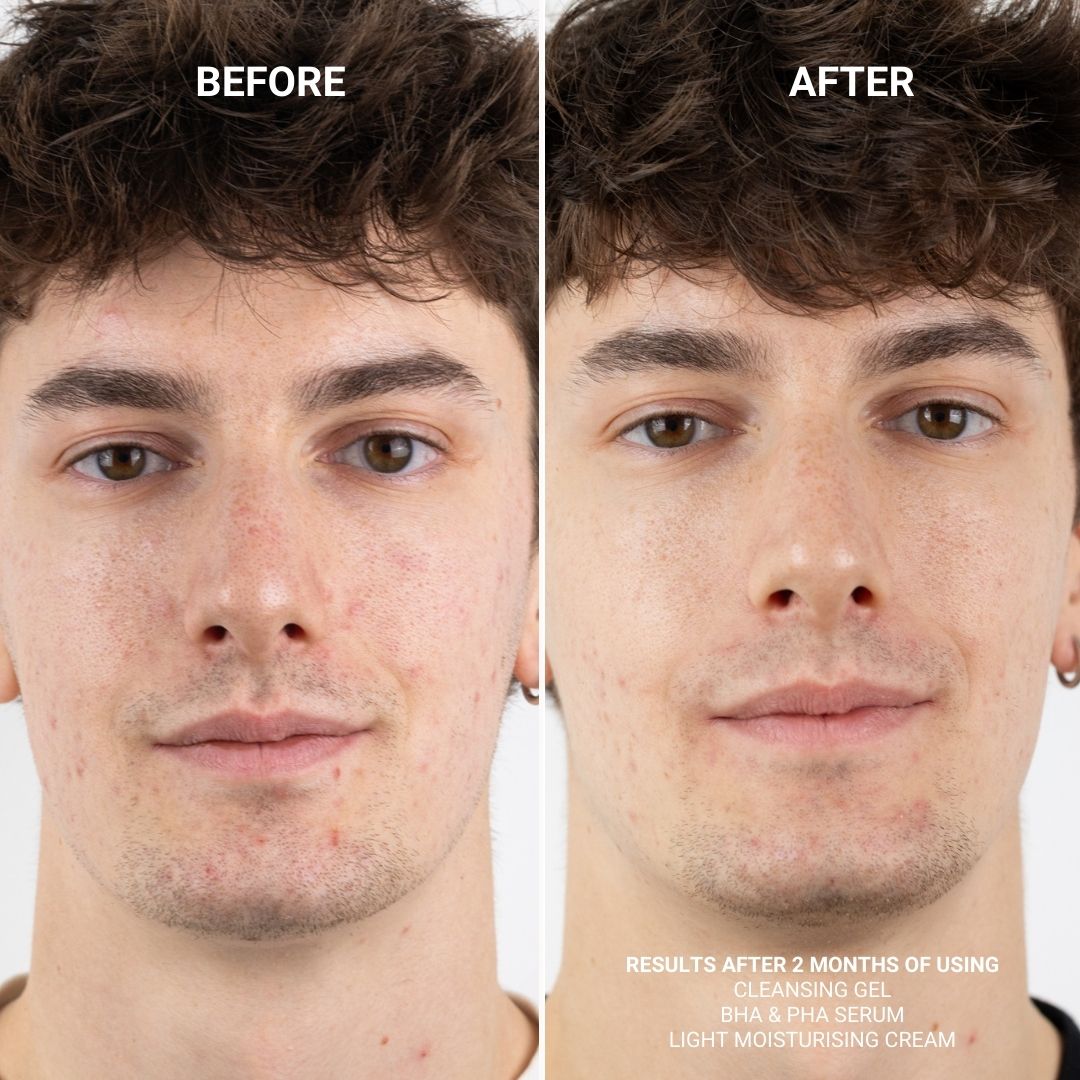 BHA & PHA SERUM