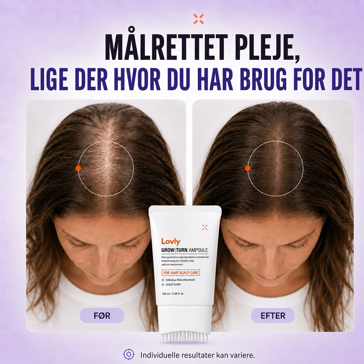 Lovly Hårvækst Serum