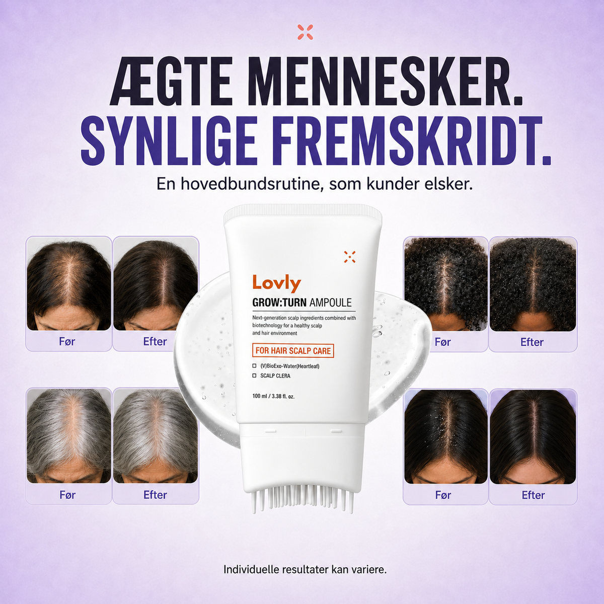 Lovly Hårvækst Serum