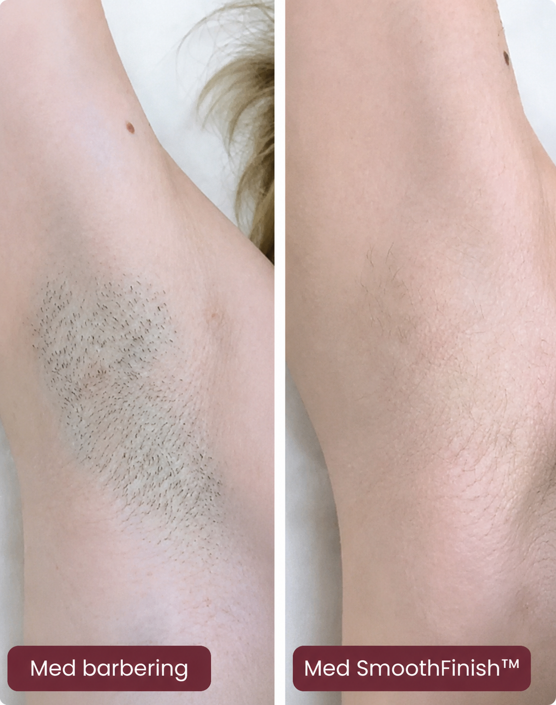 SmoothFinish 2-i-1 Ladyshaver – Glat Hud