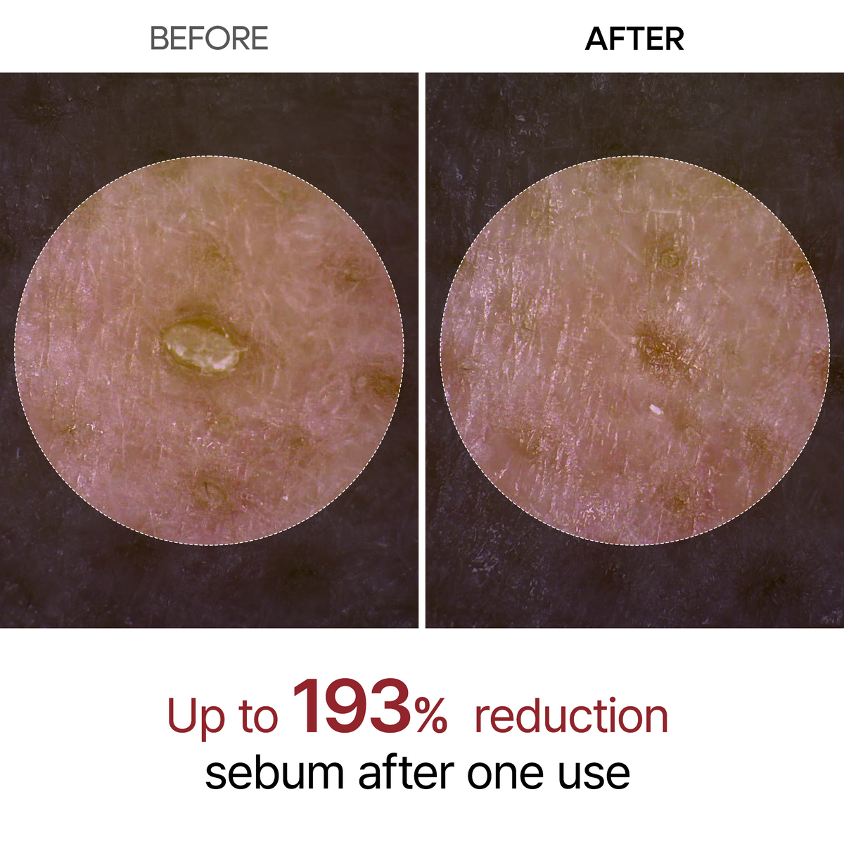 Peel Shot Glow – En lysende ansigtsserie med risekstrakter