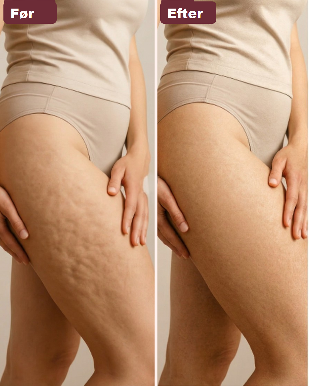 Sculpt & Smooth – Mindre Cellulite, Mere Selvtillid